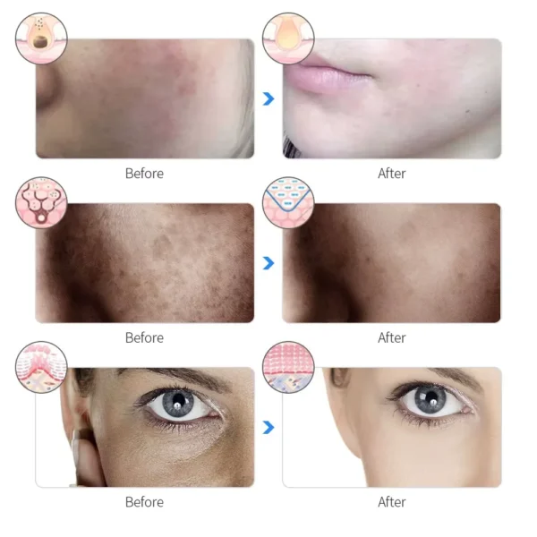 7 Colors Facial LED Mask Rechargeable PDT Photon Therapy Firming and Whitening Skin Beauty Face Machine PDT Treatment Light - Image 2