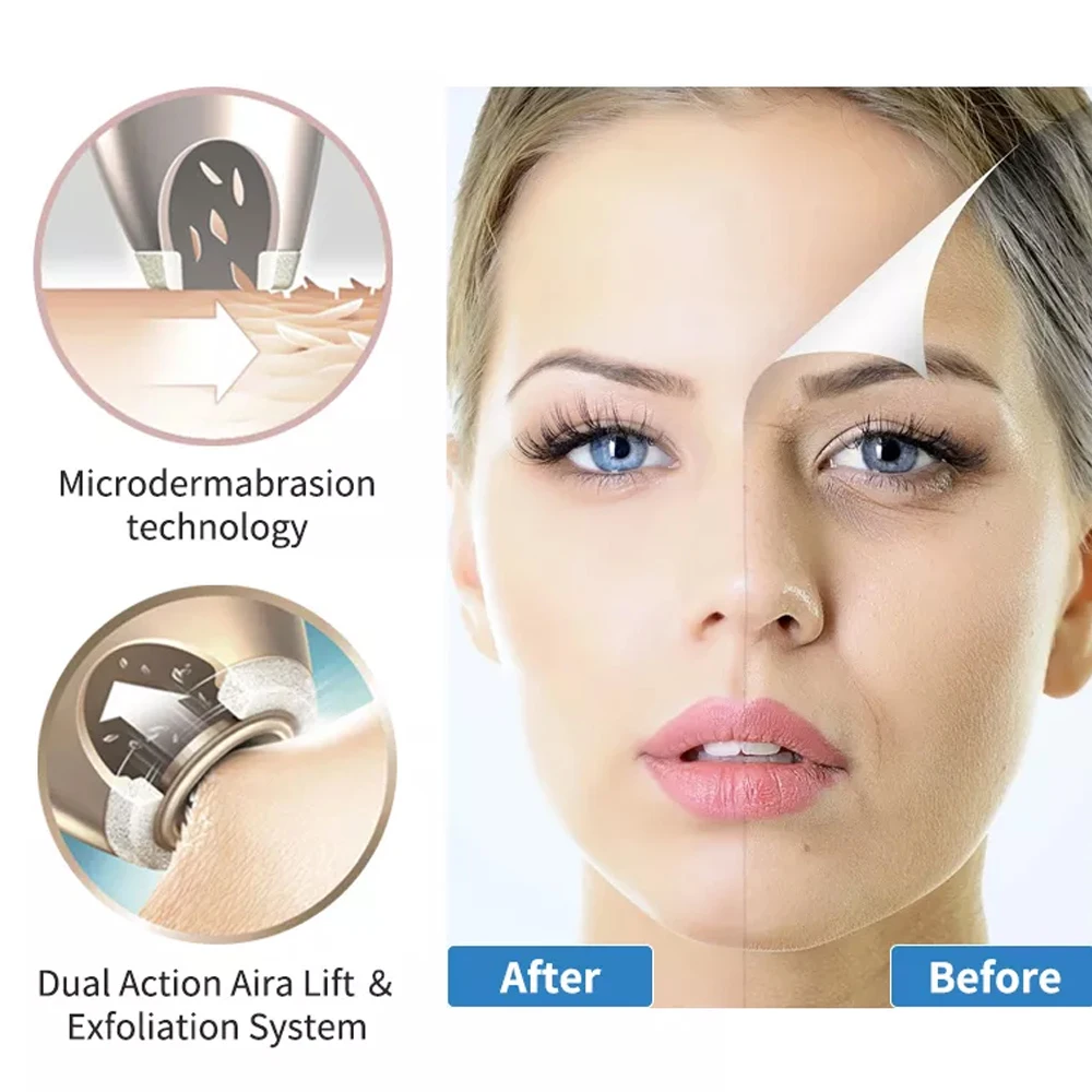 Wireless Diamond Microdermabrasion Machine For Blackhead Acne Removal Deep Cleaning Anti Aging Wrinkle Care Tool 2 Wireless Diamond Microdermabrasion Machine For Blackhead Acne Removal Deep Cleaning Anti Aging Wrinkle Care Tool - Image 2